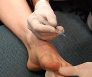 Injection into big toe