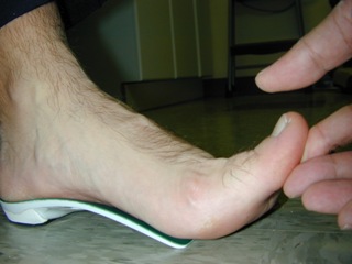 Patient standing on foot orthotic during a dispensing appointment