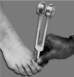 Tuning fork vibration test on big toe