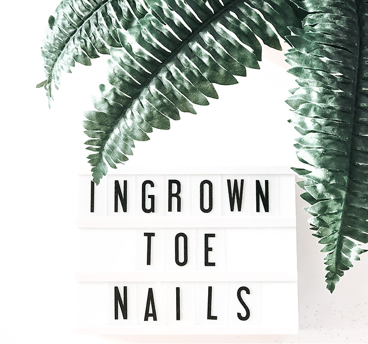 Ingrown Toenails