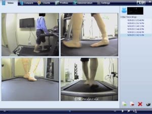 Display of video gait analysis at Whitby Family Footcare