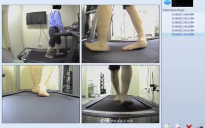 4‑Camera Gait Analysis to Find the Foot Causes of Back and Knee Pain