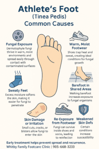 The causes of tinea pedis infographic