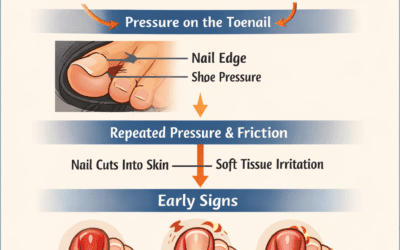 The Spring Shoe Switch: Are Your Toes Throbbing and How to Fix It