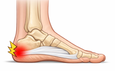 Morning Heel Pain: Why Those First Steps Hurt and How to Fix It
