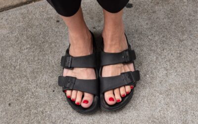 Sandal Ready? How to Clear Fungal Nails Before Summer Starts